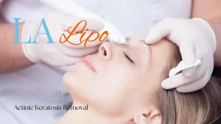 Woman receiving Actinic Keratosis Removal Treatment Swadlincote