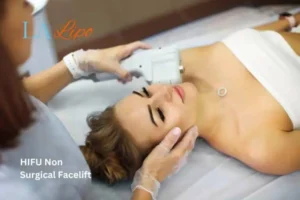 Woman having Hi-Fu to reduce wrinkles Swadlincote.