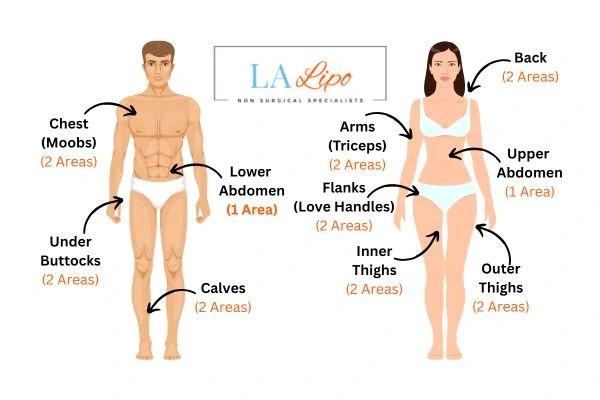 LA LIPO Cryolipolysis Areas Swadlincote
