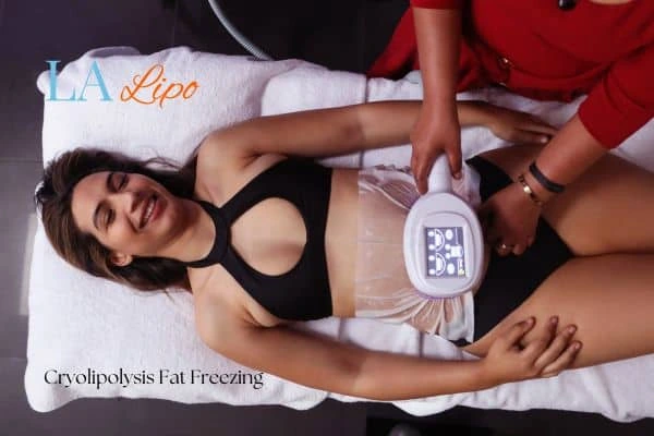 woman getting cryolipolysis Swadlincote