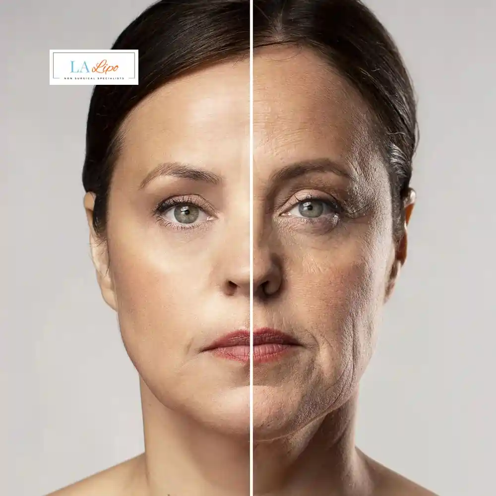 How Can You Tell If Non-Surgical Skin Tightening Is Right for You Swadlincote?