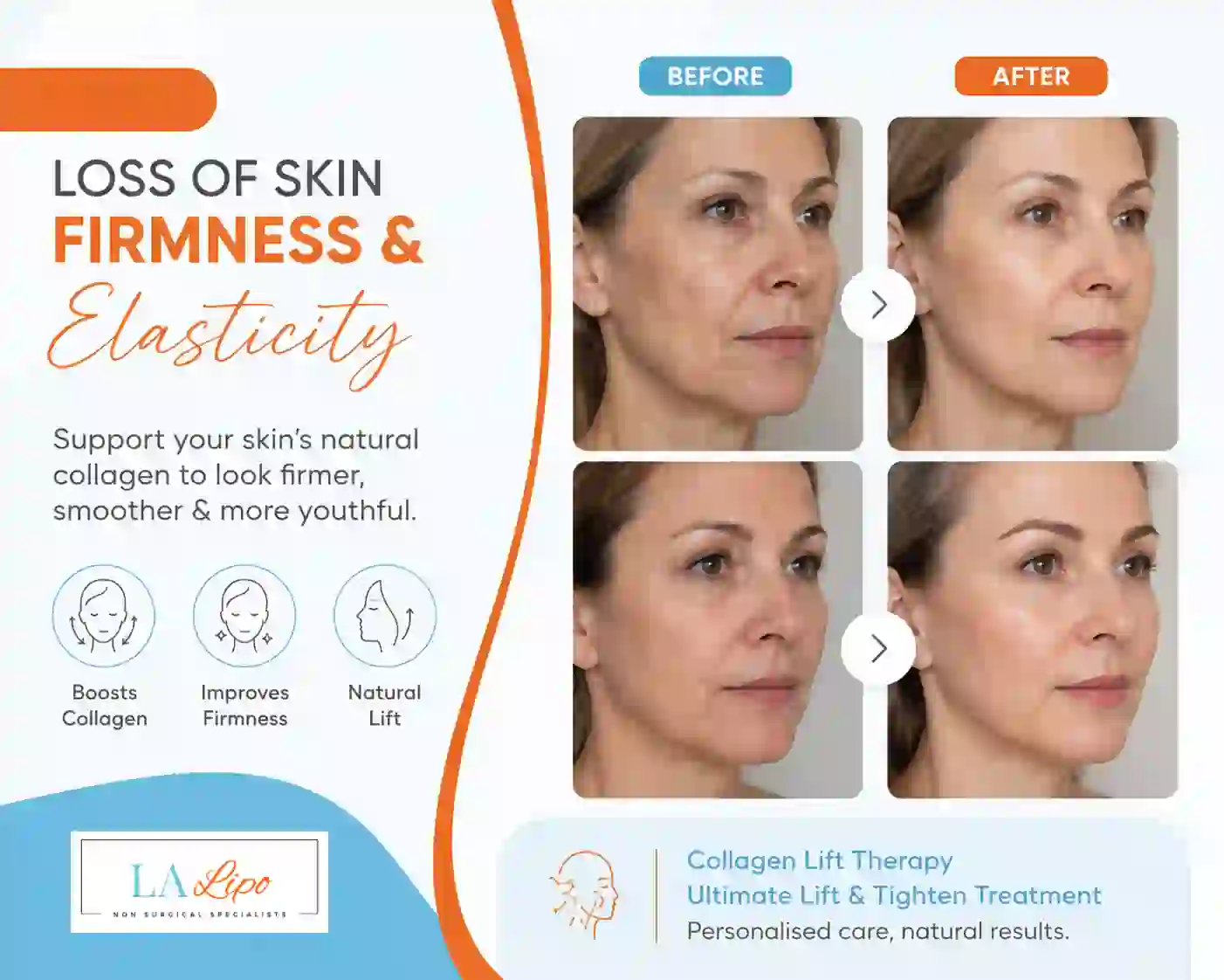 Sign #7: Loss of Skin Firmness and Elasticity Swadlincote